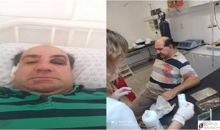 Un camionero golpeó al presidente Comunal de Cavour Marcelo Cerutti por solicitarle que no transite por el pueblo