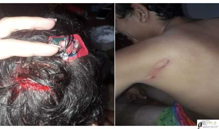 Jose Brian da el otro punto de vista de lo que sucedio en la localidad de Cavour