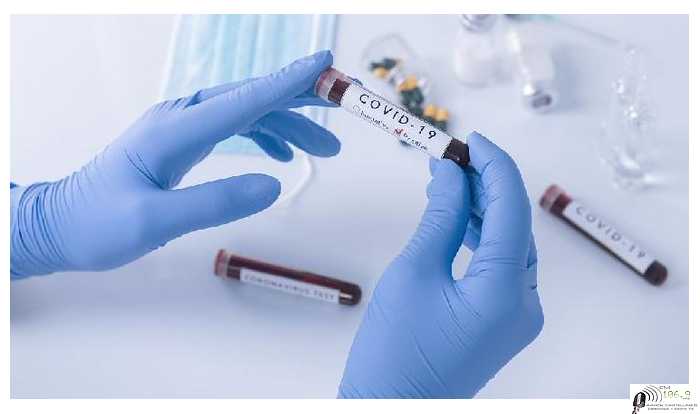 Coronavirus: 117 casos nuevos en Santa Fe y 640 en la provincia 14 muertes este lunes 7/12 ( 4 Infectados Nuevos en Esperanza)