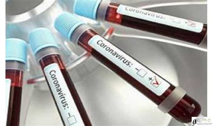 COVID 19 Aqui Informe DOMINGO 20 DIC  (15 infectados nuevos en Esperanza) ver localidades de la Provincia y Nacional