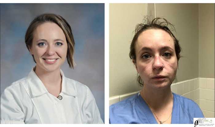 El rostro de una enfermera y la demostración de lo que hicieron meses de trabajo durante la pandemia