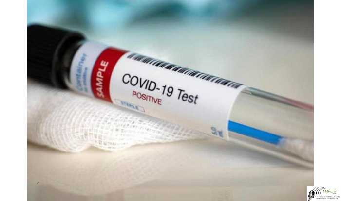 Covid  informe VIERNES 2 JULIO  Dto La Colonias 60    Esperanza 23 Humboldt 0  VER AQUI MAS