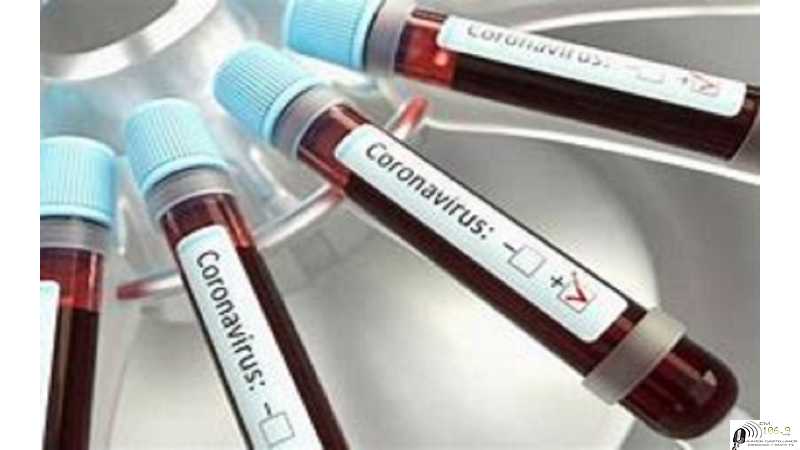 Covid  informe MARTES 24   Dto La Colonias 23    Esperanza 11  Humboldt 0  VER MAS INFORMES AQUI