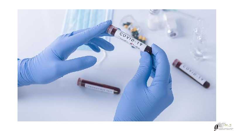 Covid  informe JUEVES 11 NOVIEMBRE Dto La Colonias 3    Esperanza 0  Franck 3  VER MAS INFORMES AQUI